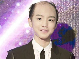 TFBOYS王俊凯地中海